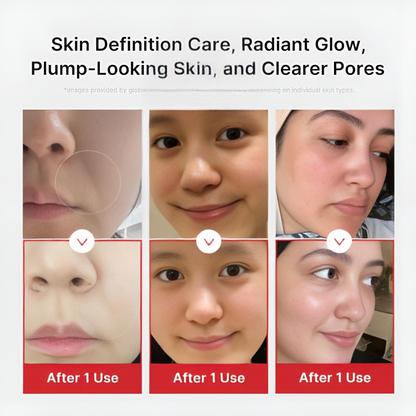 Vitalyn Age-R Booster Pro | Beauty Massager